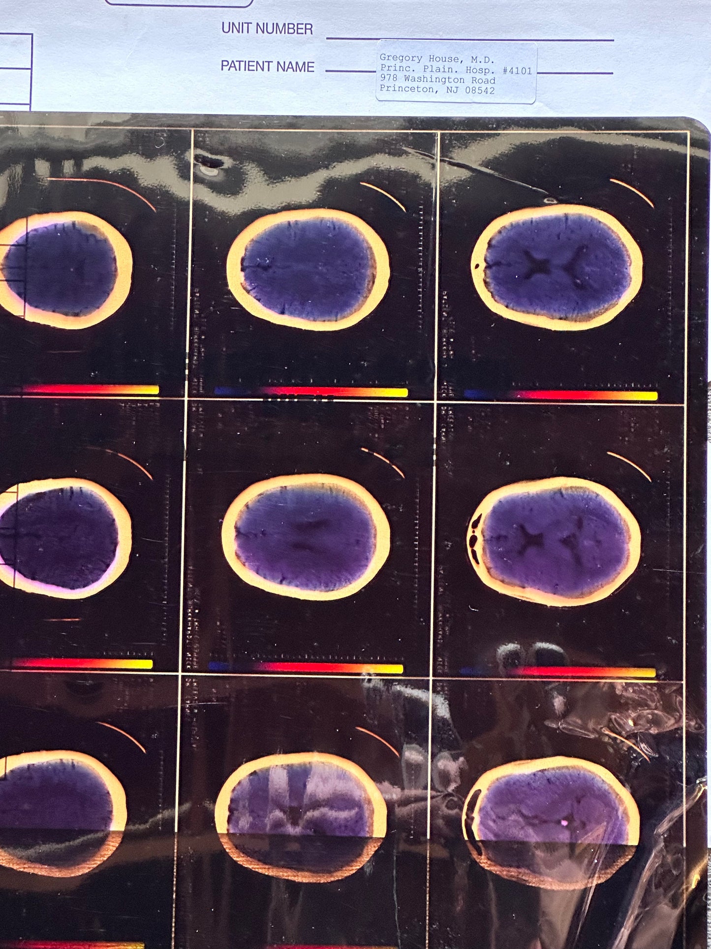 House: Dr. Gregory House's Brain X-Ray on Large Film Sheet (1 of 1)