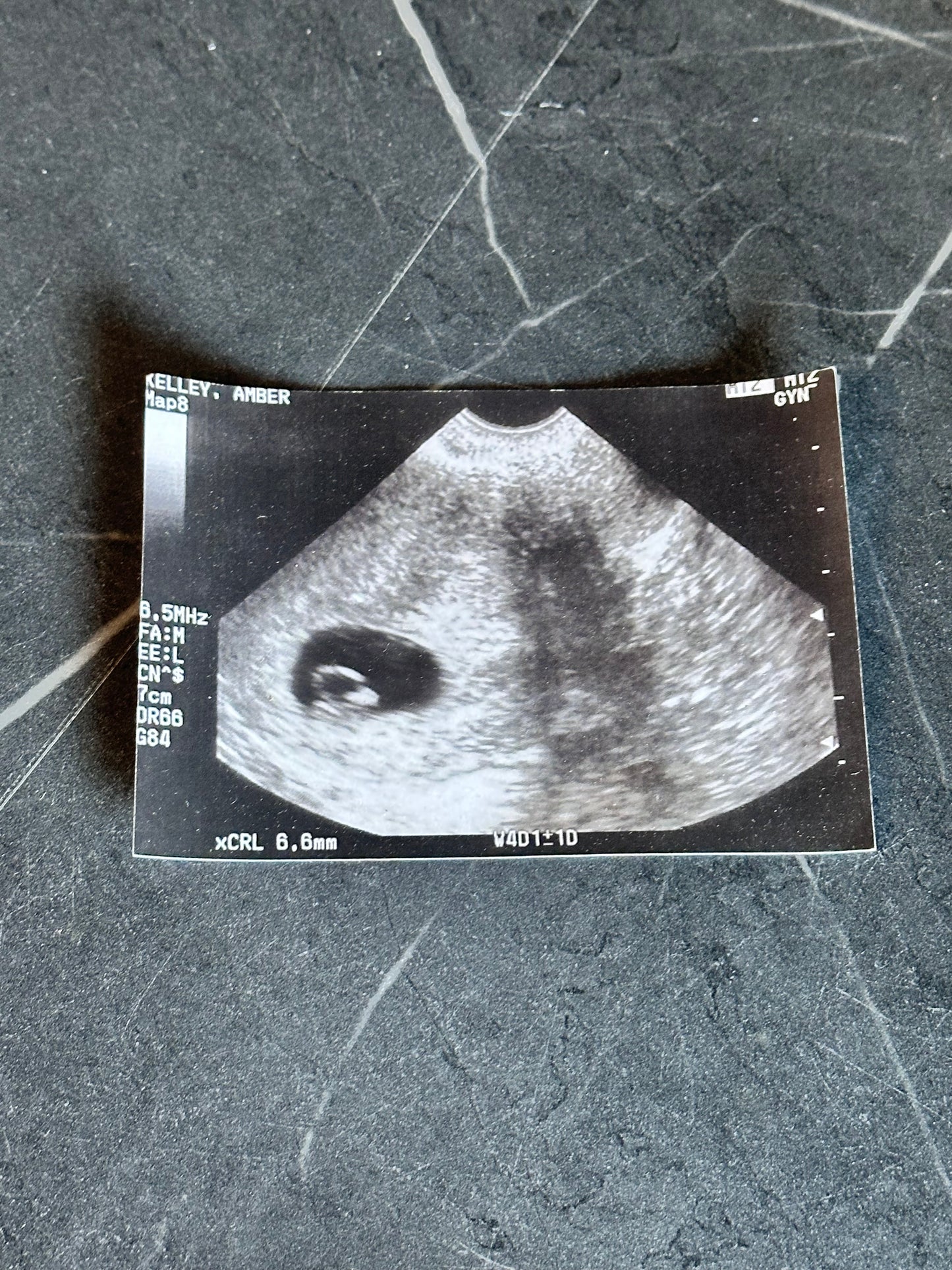 BALLERS: Julie’s HERO Pregnancy Photo