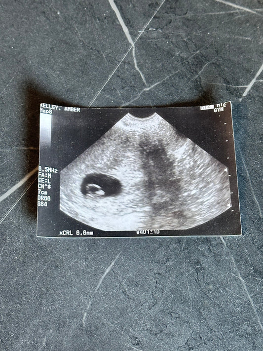 BALLERS: Julie’s HERO Pregnancy Photo