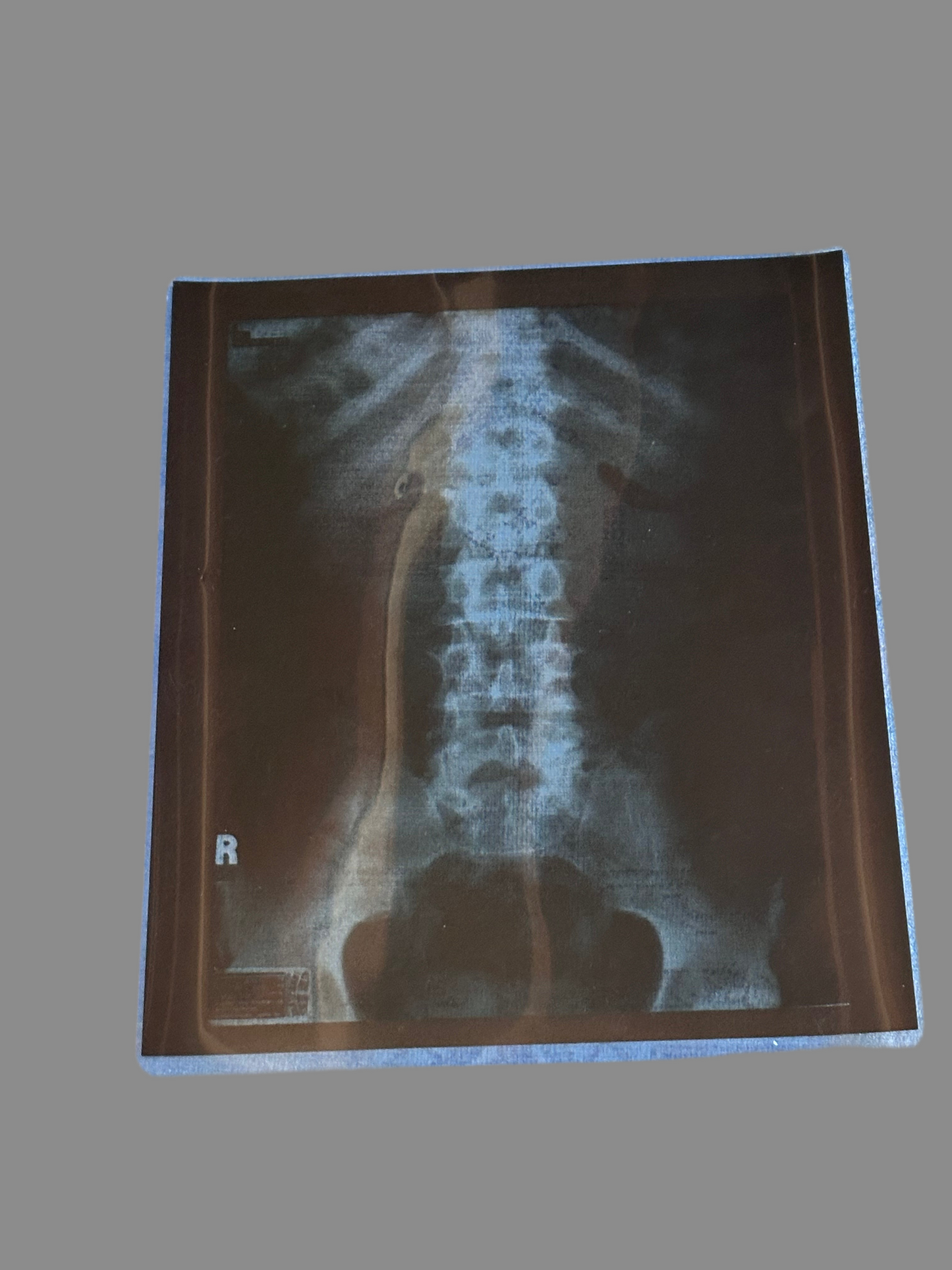 House: Dr. Gregory House's Spine X-Ray on Large Film Sheet