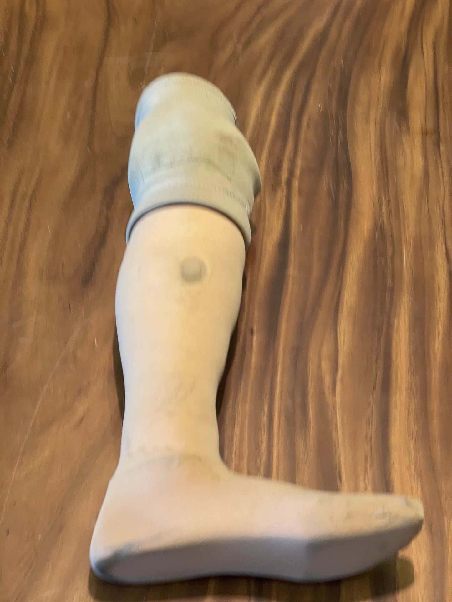 SOA: Bobby's Prop Leg from Explosion